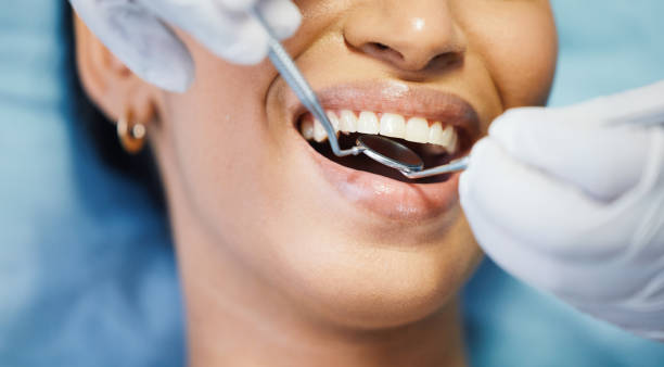 Best Walk-In Emergency Dentist in Helotes, TX