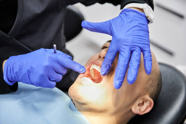 Best Emergency Dental Surgery in Helotes, TX