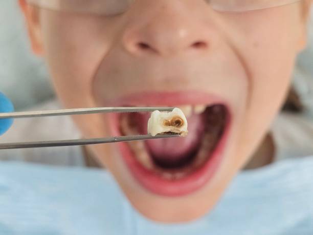 Best Pediatric Emergency Dentist in Helotes, TX